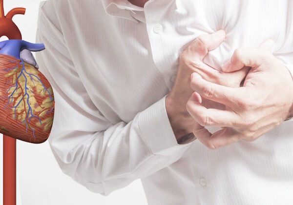 Інфаркт міокарда